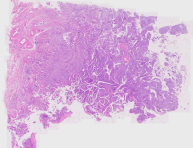 Uterine-10x